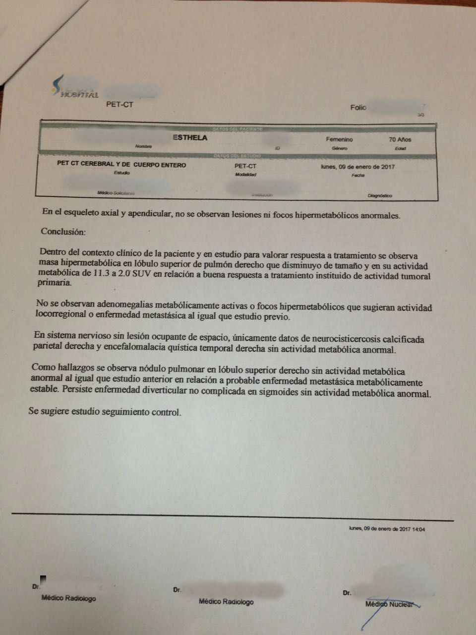 LifEscozul® - Esthela 2 - Cáncer de Pulmon