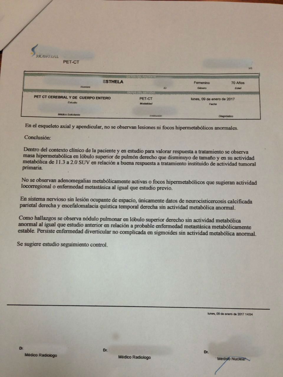 LifEscozul® - Esthela 3 - Cáncer de Pulmon