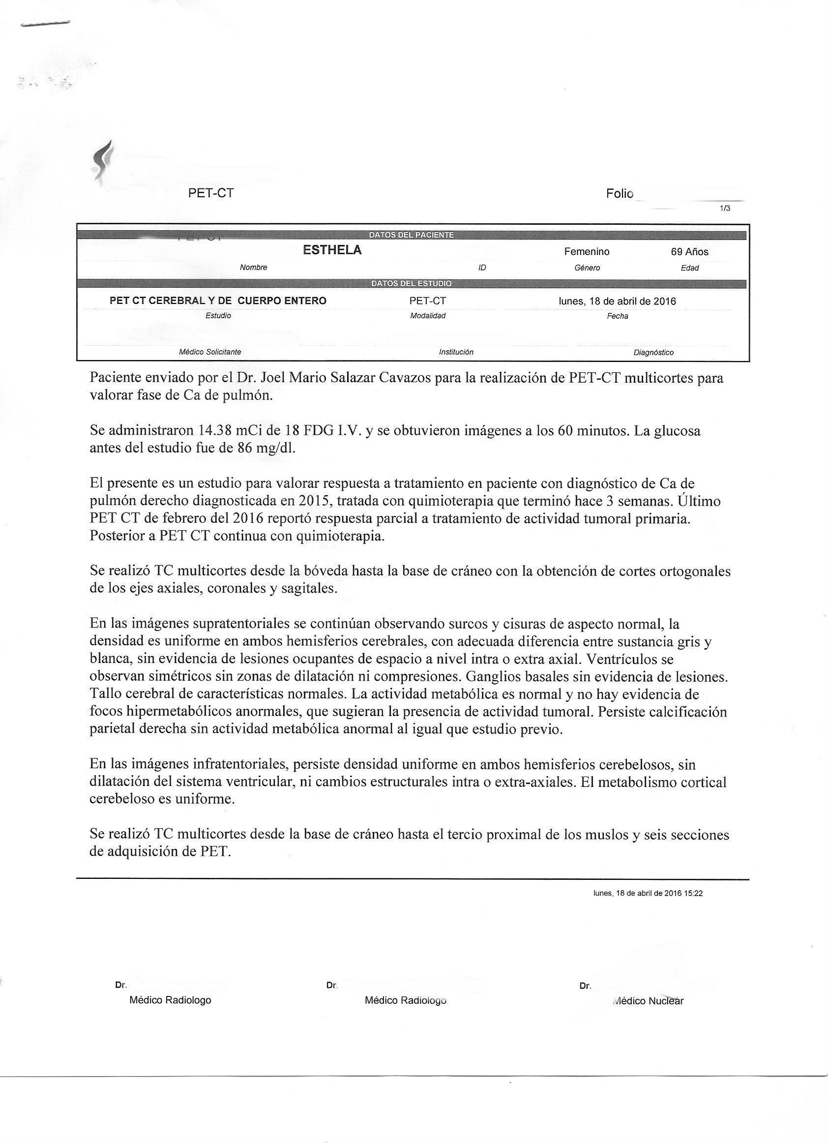 LifEscozul® - Esthela 4 - Cáncer de Pulmon