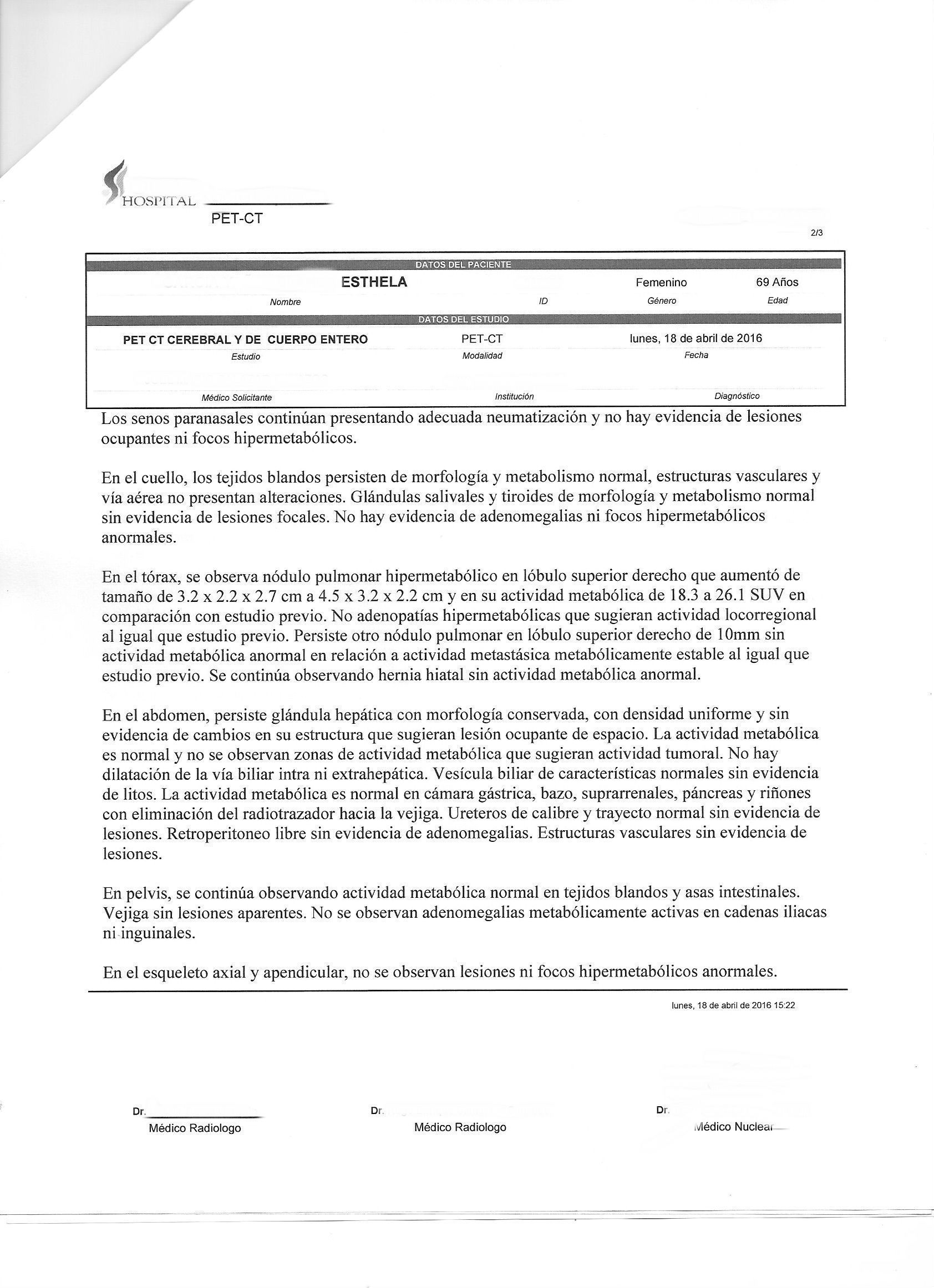 LifEscozul® - Esthela 6 - Cáncer de Pulmon