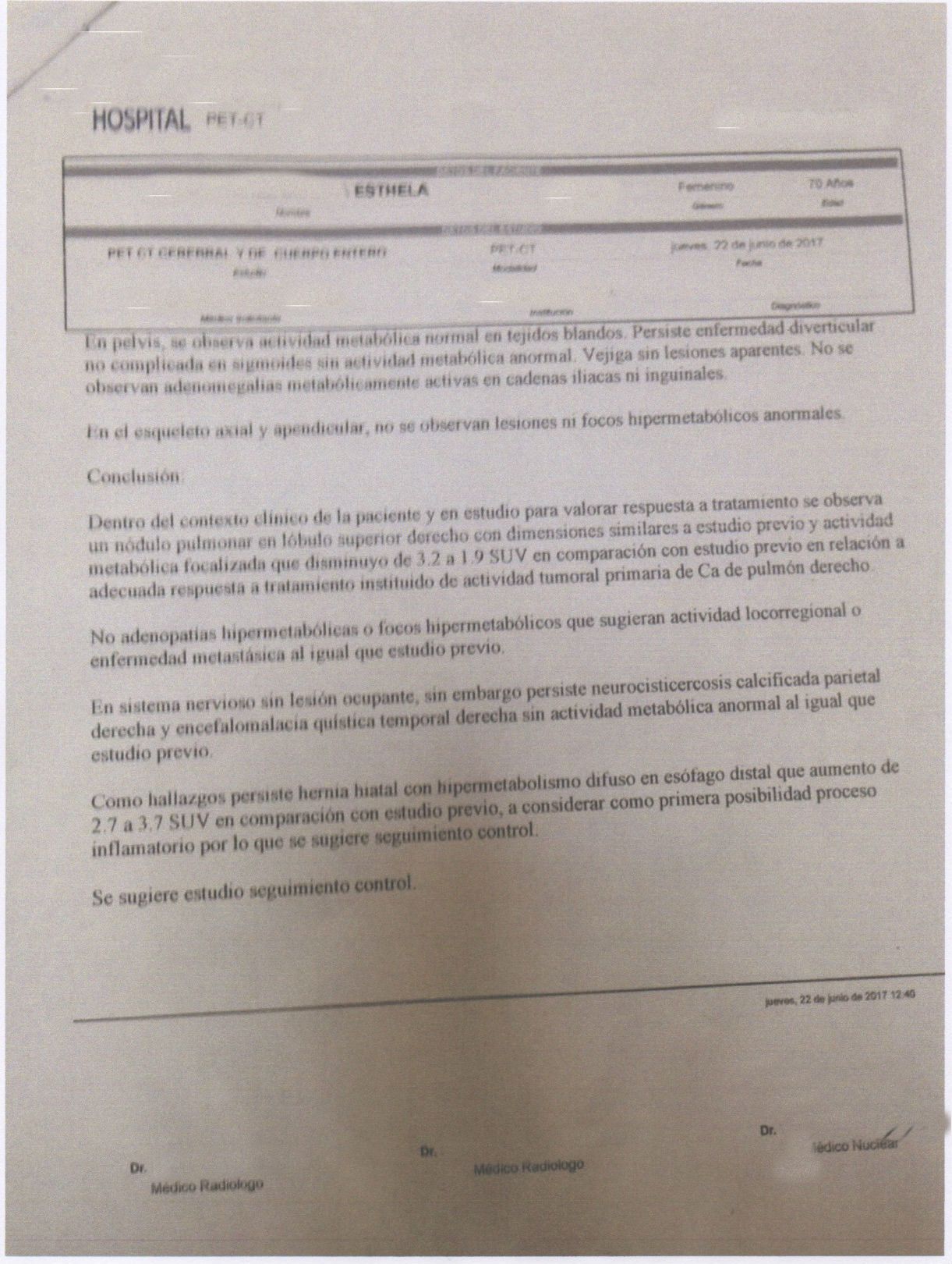 LifEscozul® - Esthela 7 - Cáncer de Pulmon