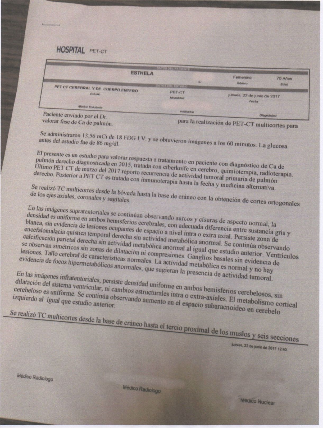 LifEscozul® - Esthela 8 - Cáncer de Pulmon