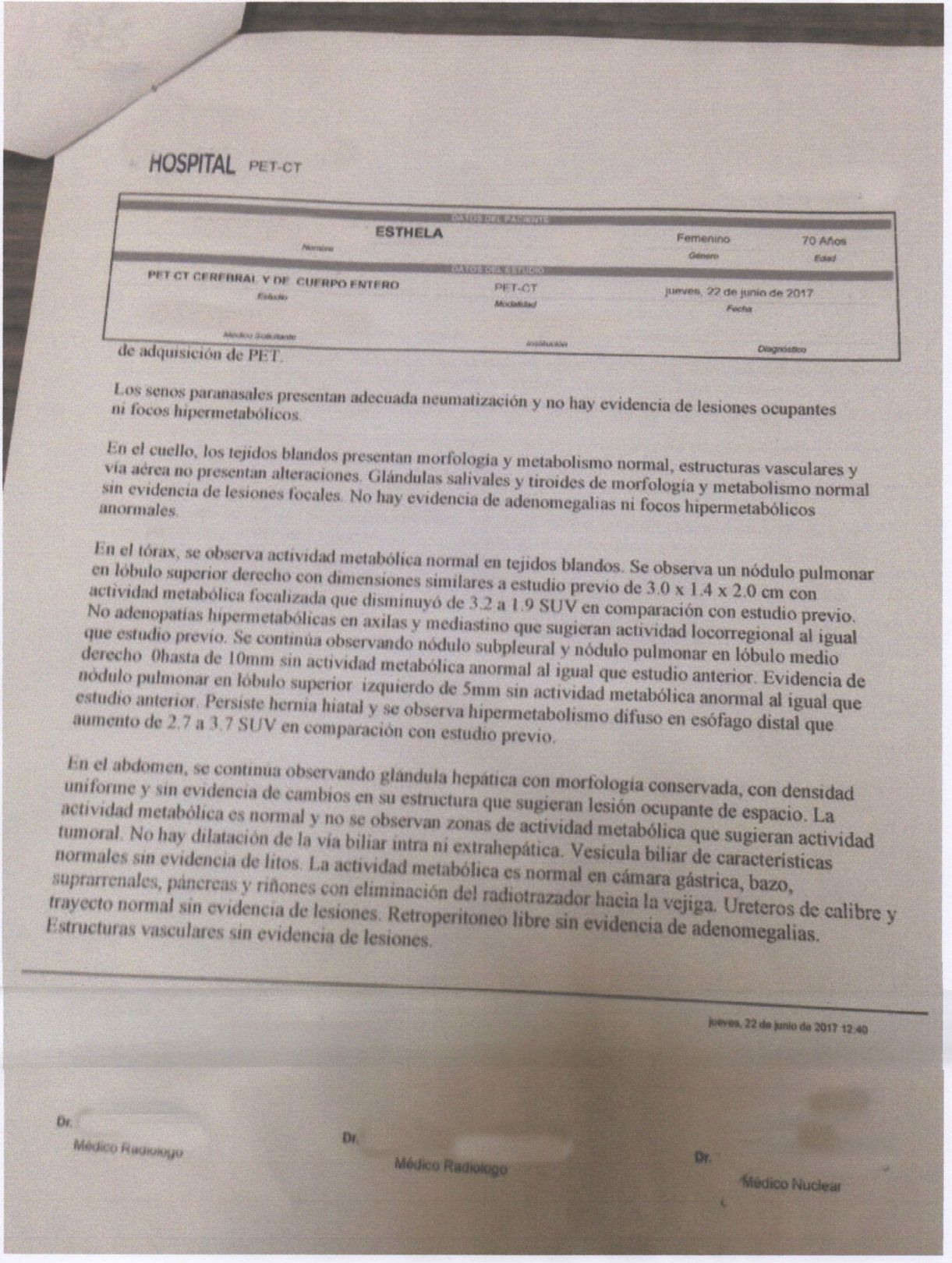 LifEscozul® - Esthela 9 - Cáncer de Pulmon