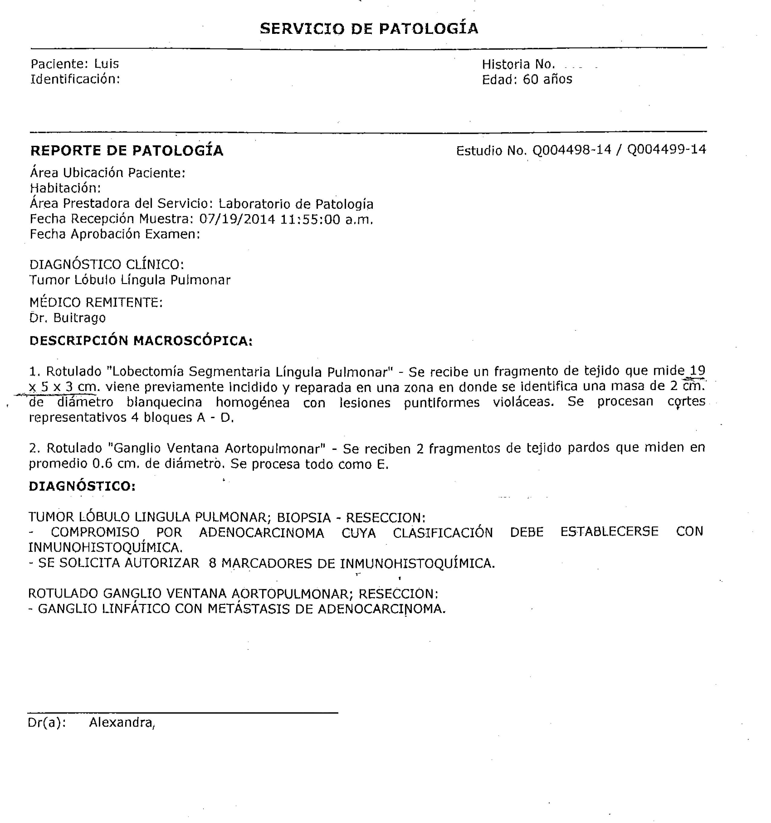 LifEscozul® - Luis 1 - Cáncer de Pulmon