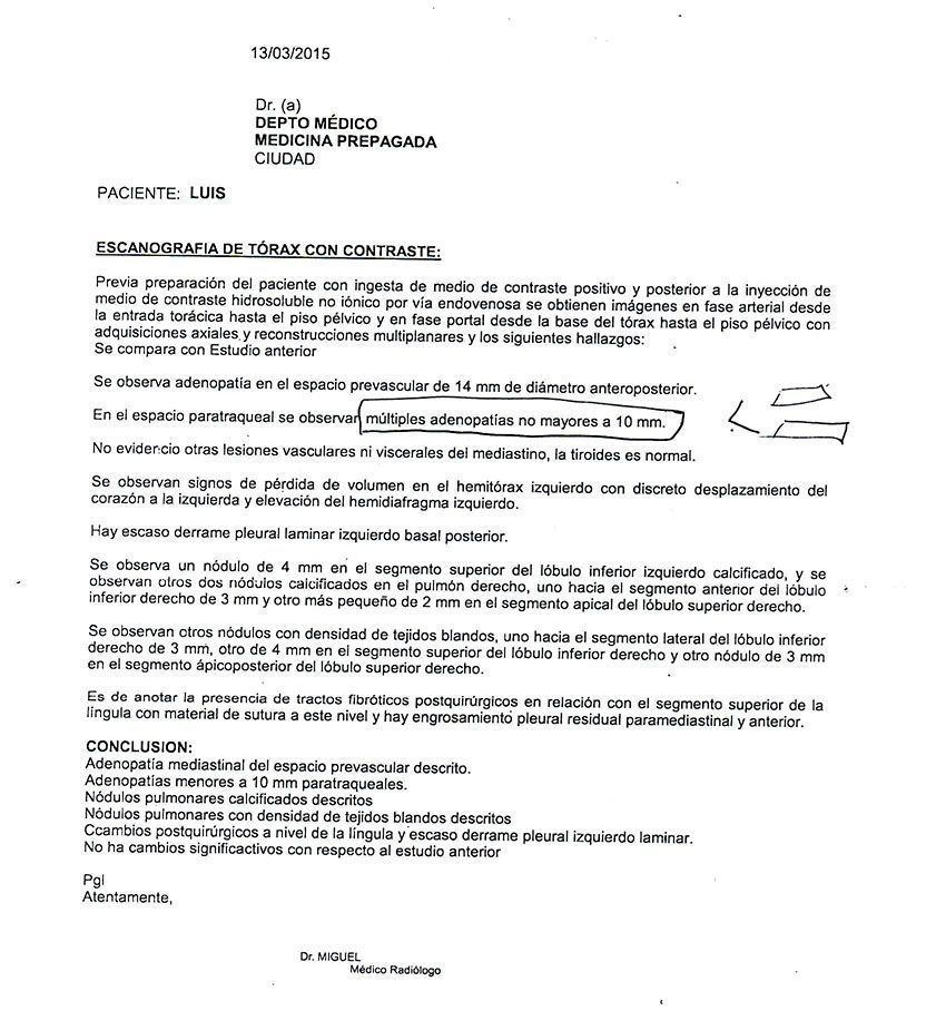 LifEscozul® - Luis 18 - Cáncer de Pulmon