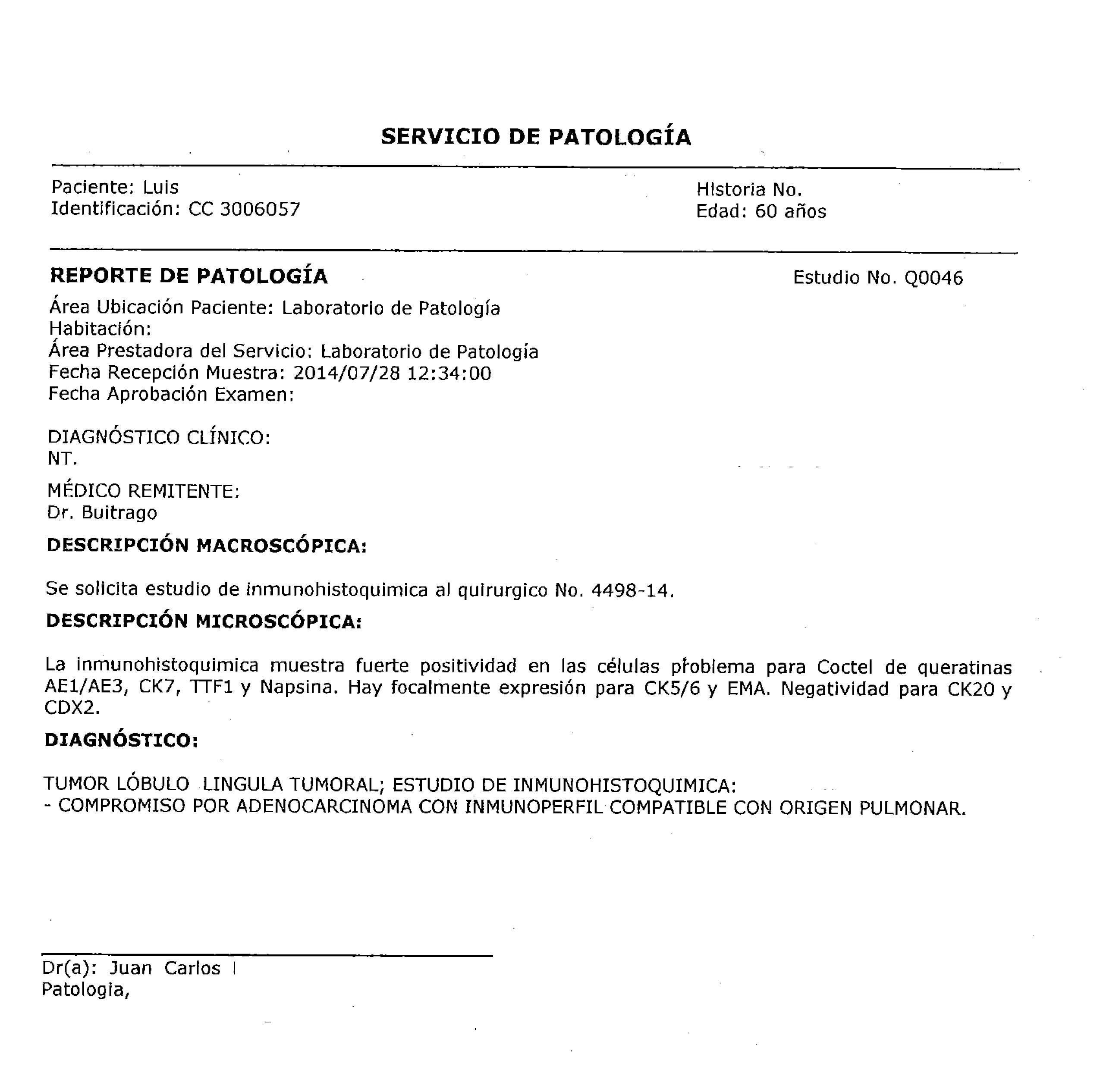 LifEscozul® - Luis 3 - Cáncer de Pulmon