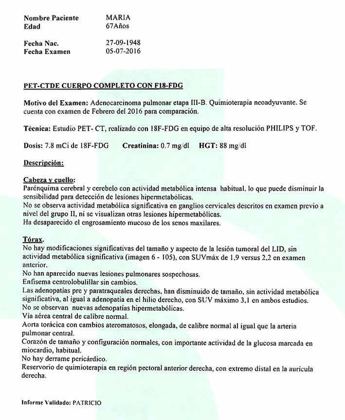 LifEscozul® - María 1 - Cáncer de Pulmon