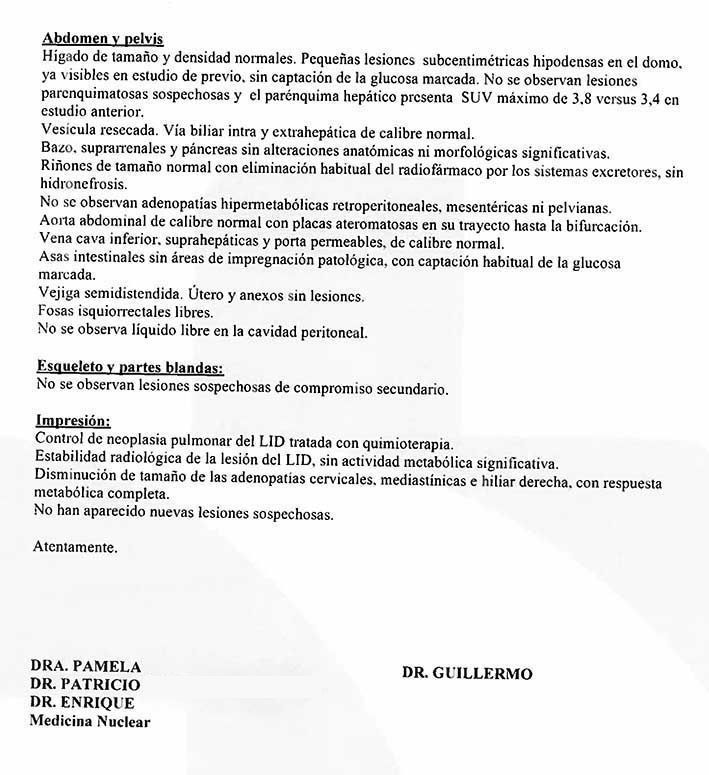 LifEscozul® - María 10 - Cáncer de Pulmon