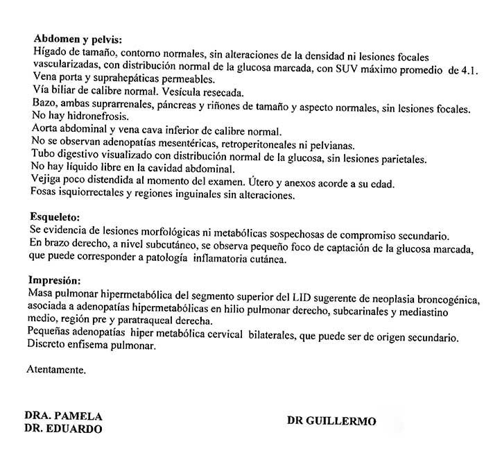 LifEscozul® - María 11 - Cáncer de Pulmon