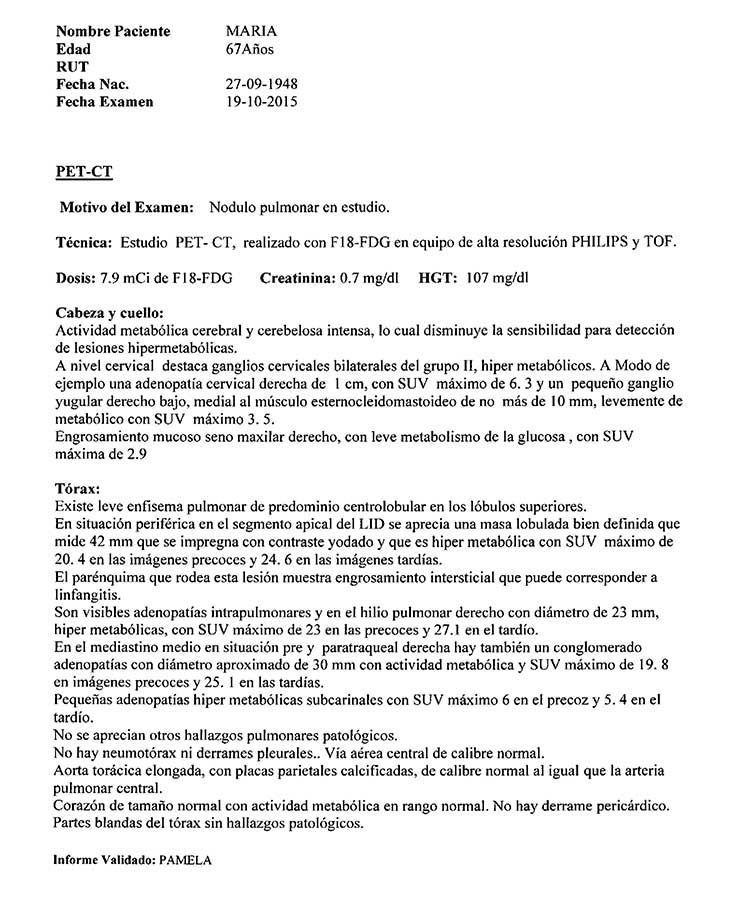 LifEscozul® - María 5 - Cáncer de Pulmon