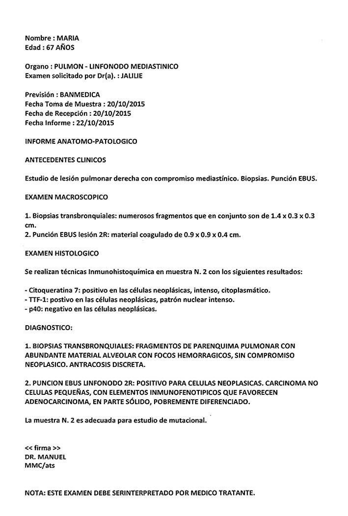 LifEscozul® - María 6 - Cáncer de Pulmon