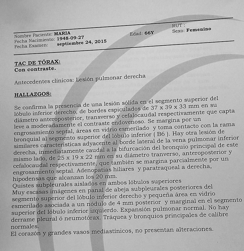 LifEscozul® - María 9 - Cáncer de Pulmon