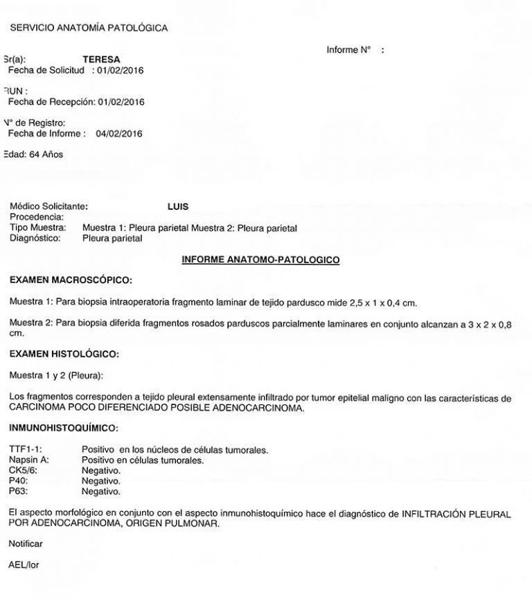 LifEscozul® - Teresa 10 - Cáncer de Pulmon