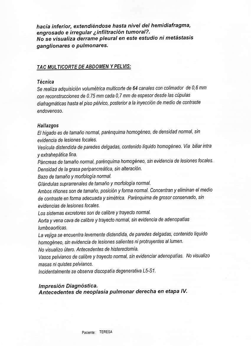 LifEscozul® - Teresa 12 - Cáncer de Pulmon