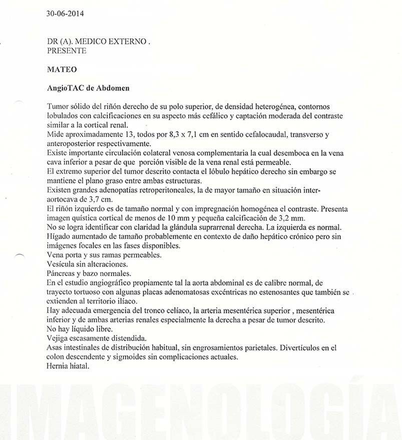 LifEscozul® - Mateo 4 - Cáncer de Riñon