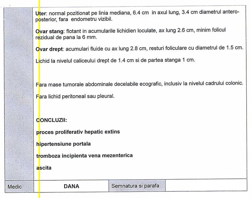 LifEscozul&reg; - Carmen 5 - Cáncer de Hígado