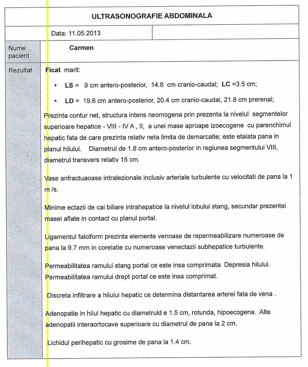 LifEscozul&reg; - Carmen 6 - Cáncer de Hígado