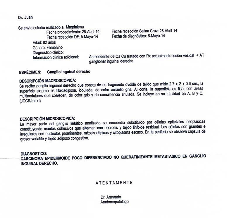 LifEscozul® - Magdalena 1 - Cáncer de Útero y Cervix