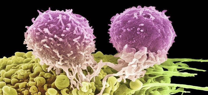 LifEscozul&reg; - Cáncer gástrico e intestinal