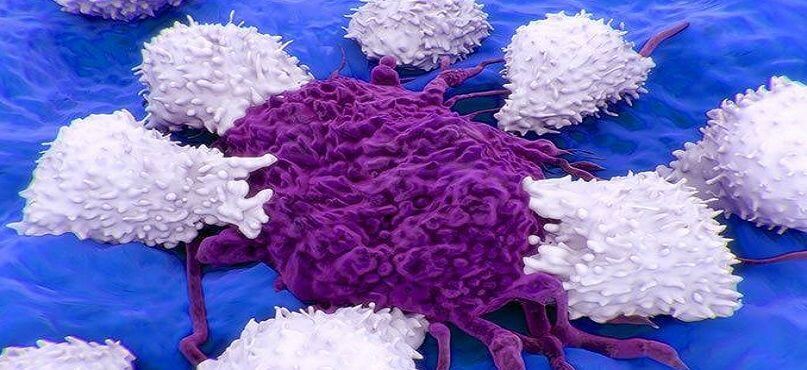 LifEscozul&reg; - Cáncer de Riñon