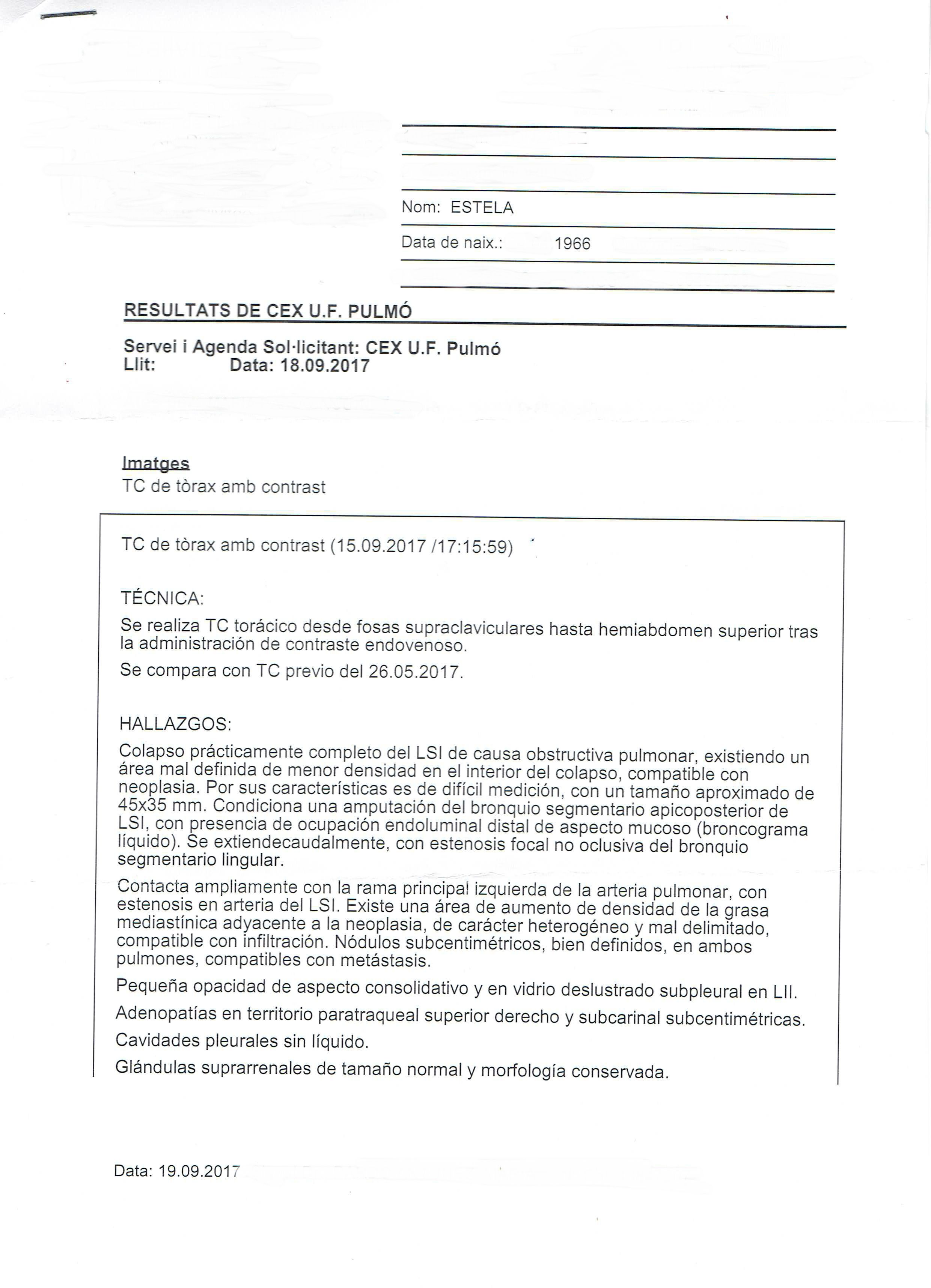 LifEscozul® - Estela 4 - Cáncer de Pulmon