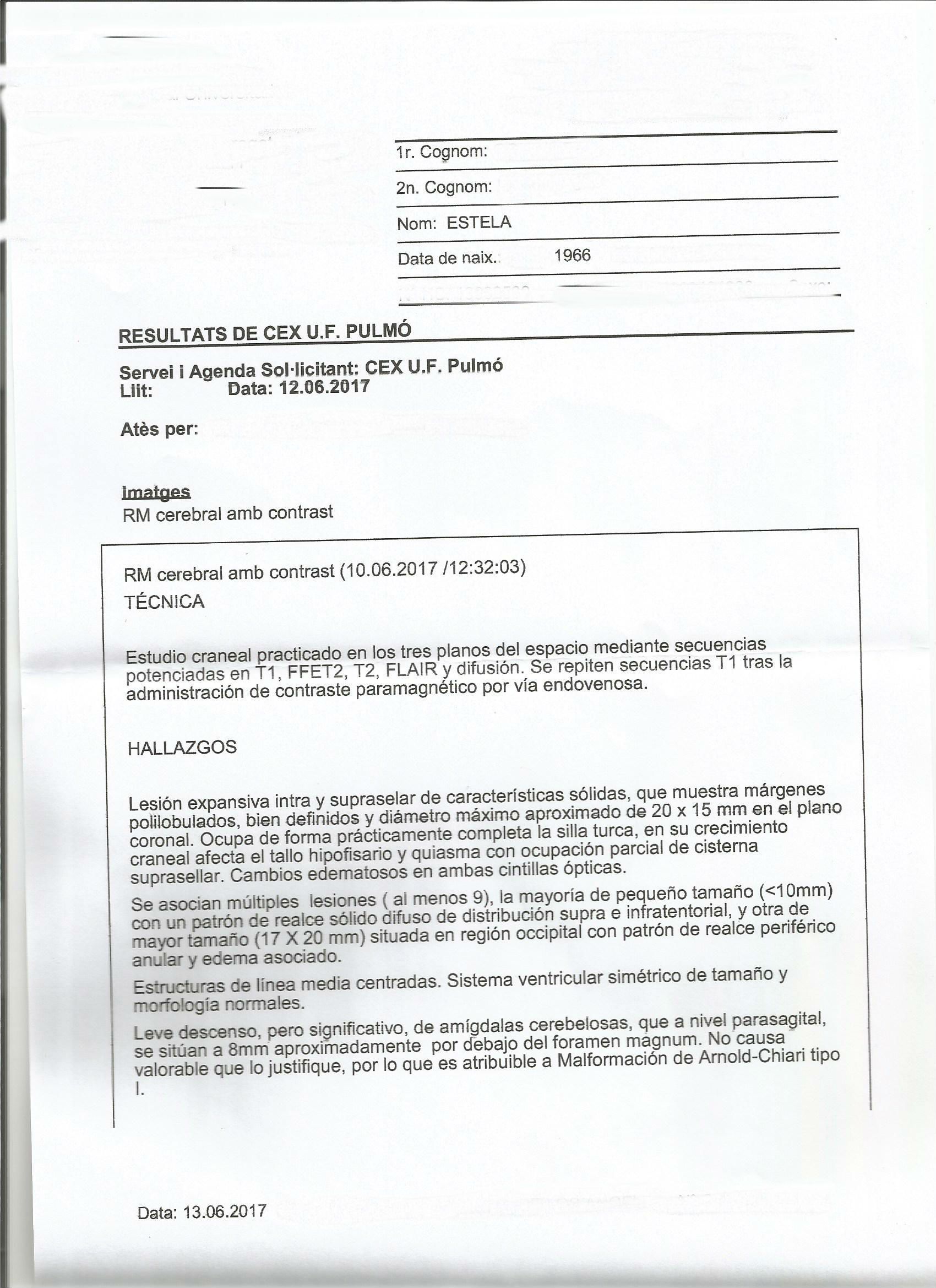 LifEscozul® - Estela 7 - Cáncer de Pulmon