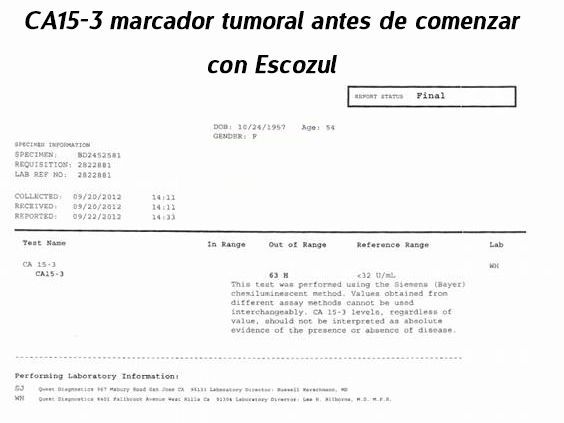 LifEscozul&reg; - Josefina Romero 4 - Cáncer de Mámas