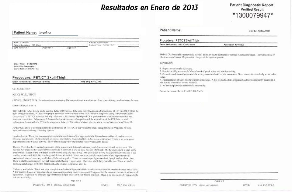 LifEscozul&reg; - Josefina Romero 7 - Cáncer de Mámas