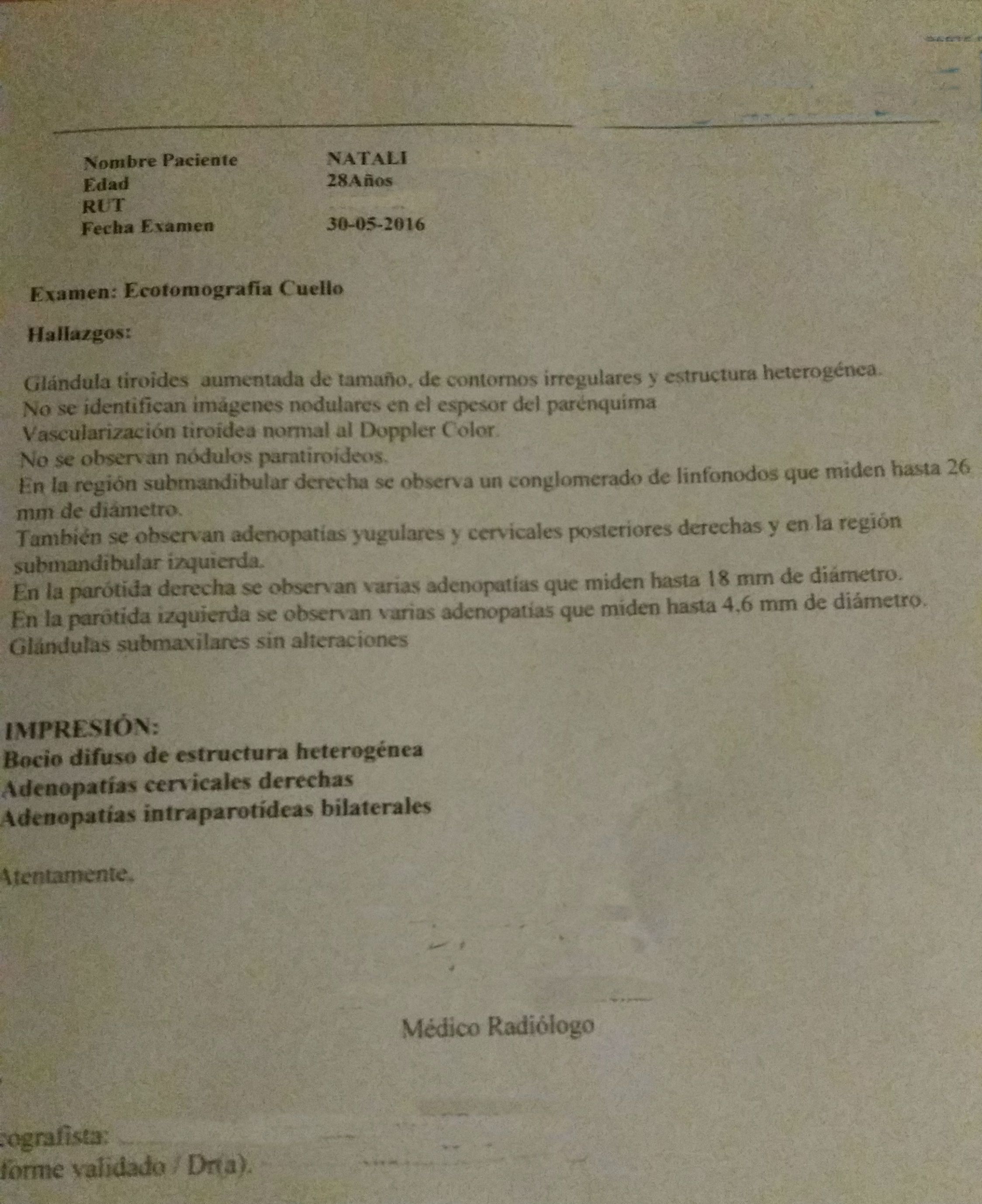 LifEscozul&reg; - Natali 1 - Linfómas