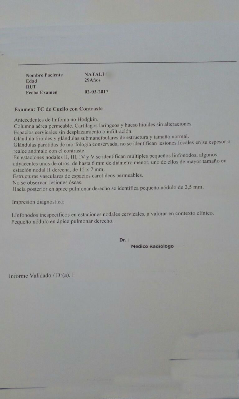 LifEscozul&reg; - Natali 2 - Linfómas