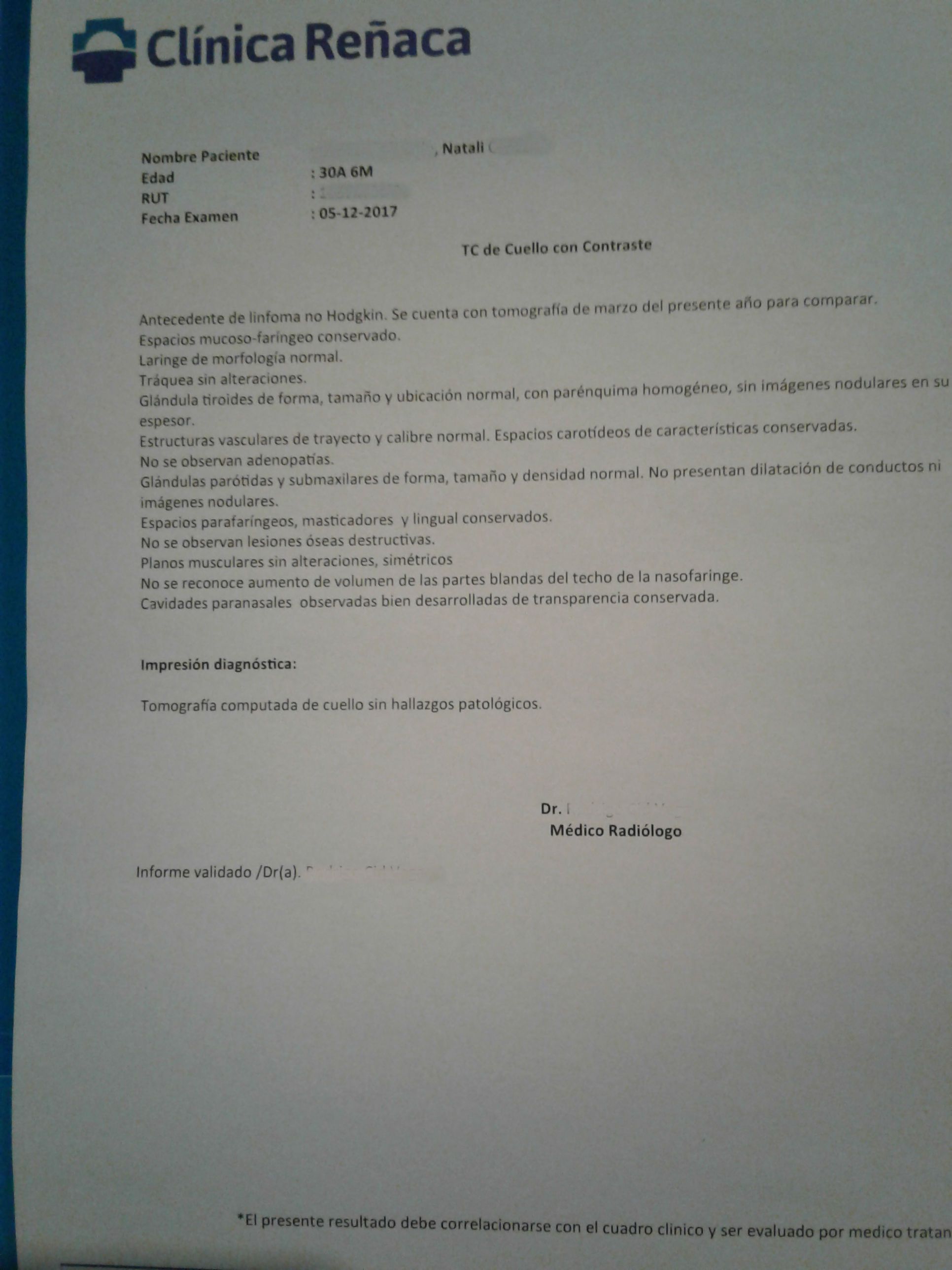 LifEscozul&reg; - Natali 4 - Linfómas