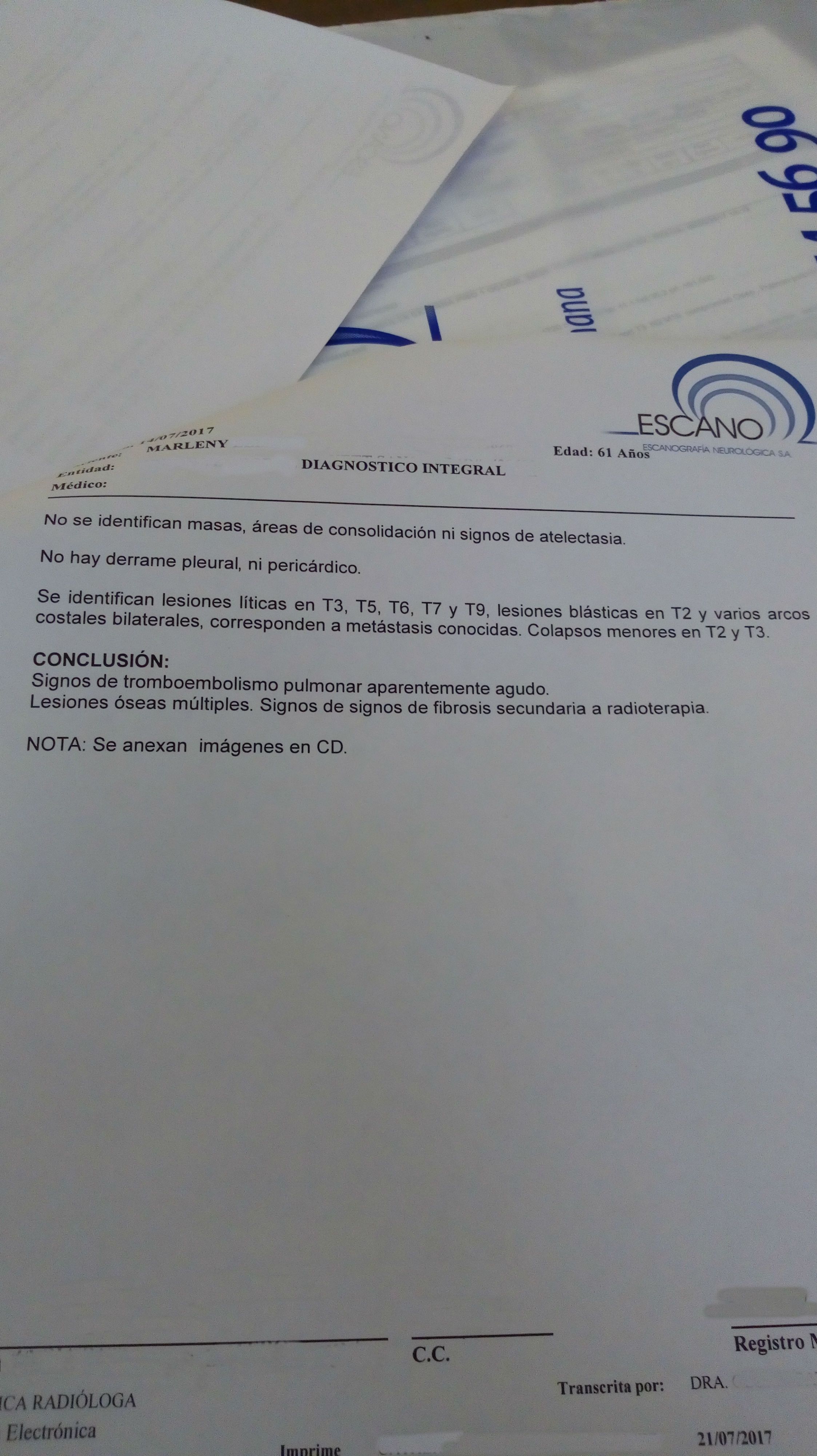 LifEscozul® - Marleny 2 - Cáncer de Pulmon