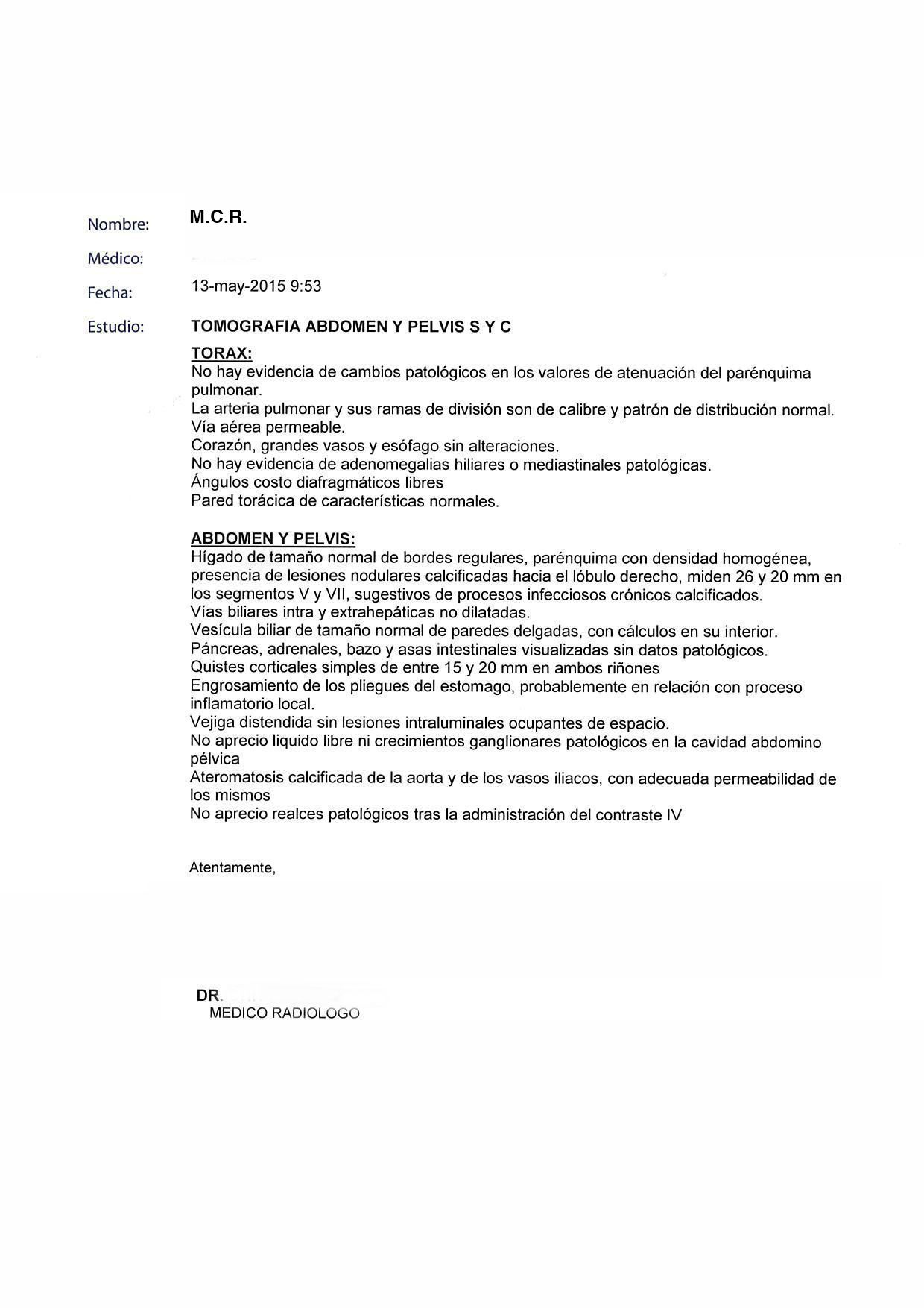 LifEscozul® - M.C.R. 4 - Cáncer de Ovarios