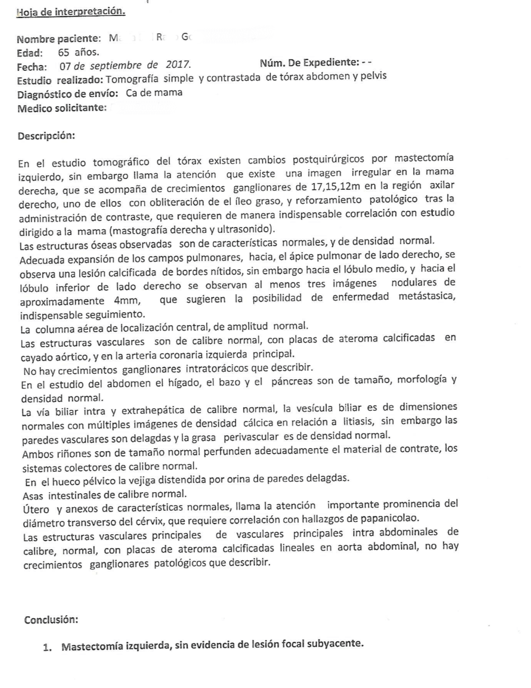 LifEscozul&reg; - M.R.G. 5 - Cáncer de Mámas
