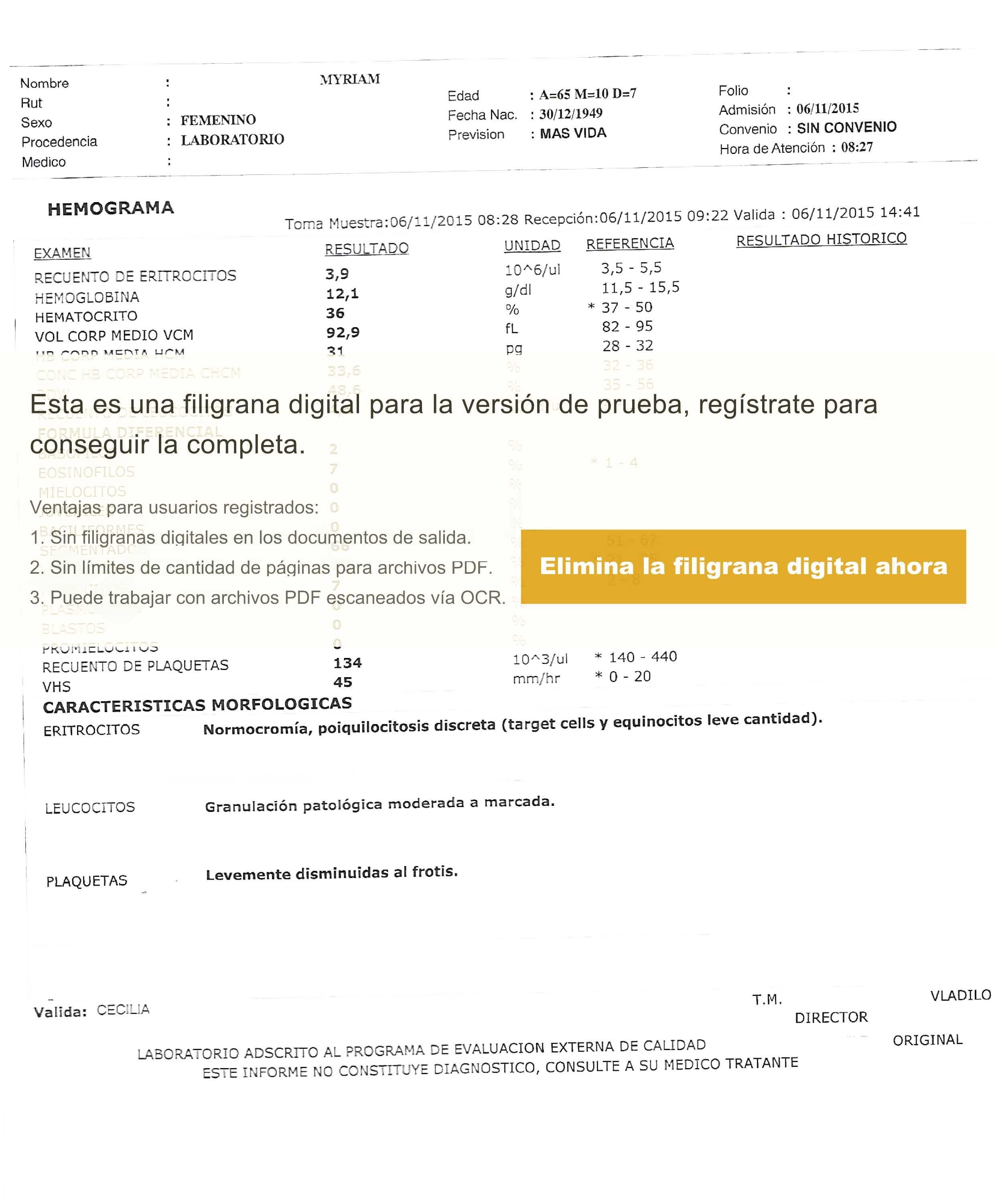 LifEscozul® - Miriam 5 - Cáncer de Pulmon