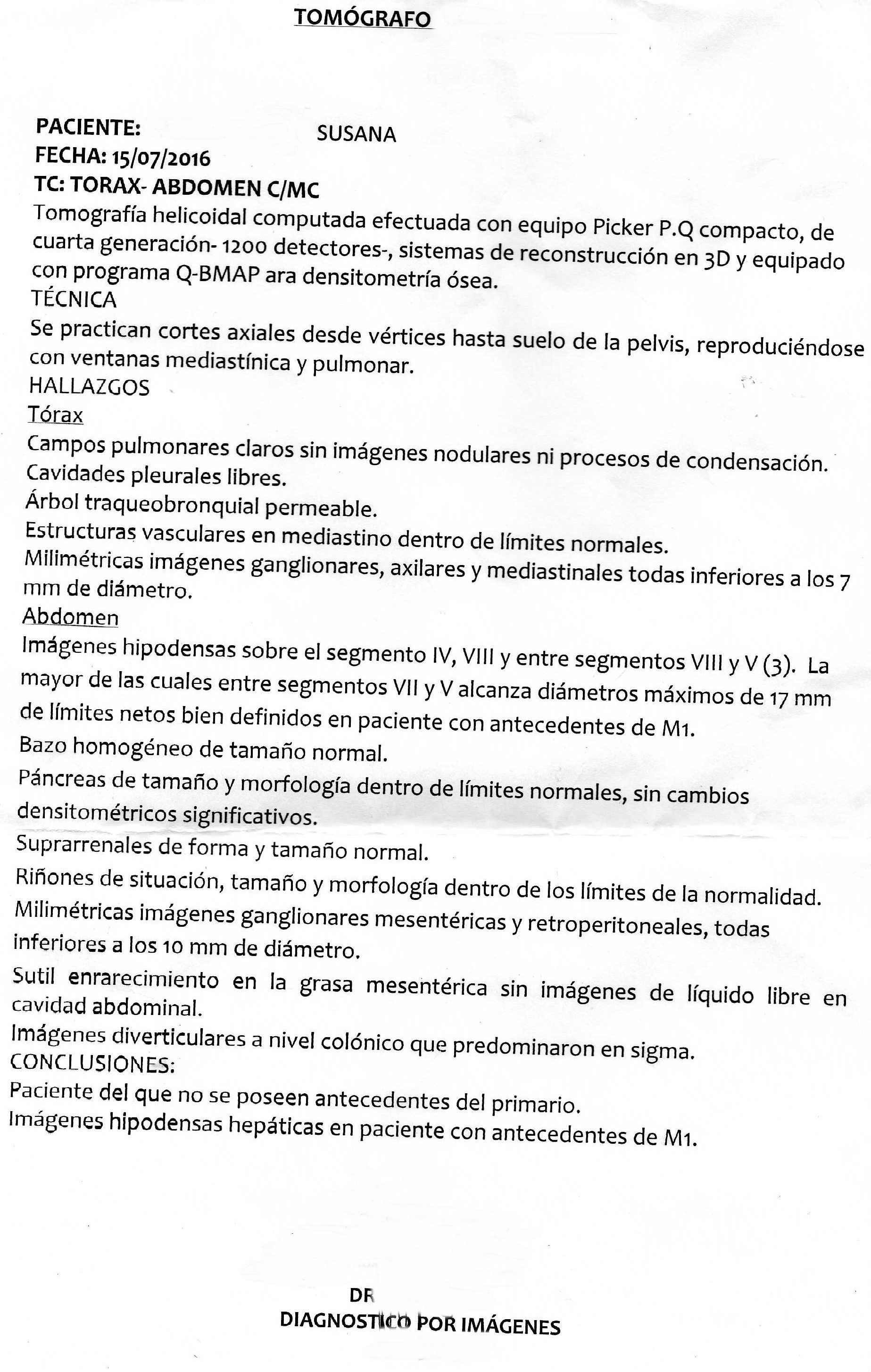 LifEscozul&reg; - Susana 3 - Cáncer Gástrico Intestinal